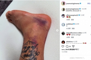 重磅澳大利亚对阵世界杯美国首发阵容_重磅澳大利亚对阵世界杯美国首发阵容在线观看_免费看直播